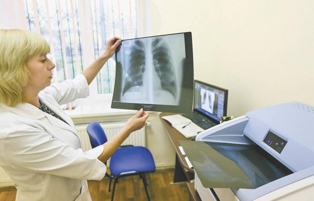 Рентген чи КТ? Розповідаємо, який із цих методів дослідження більш інформативний при COVID-19 і чому Рентген чи КТ? Розповідаємо, який із цих методів дослідження більш інформативний при COVID-19 і чому