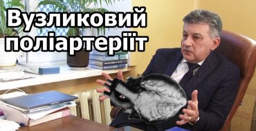 Мініатюра